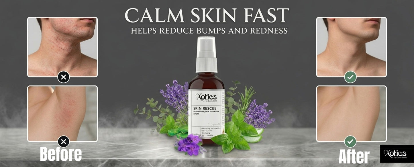 Skin Rescue Spray – Hydrating & Soothing Mist for Skin Repair