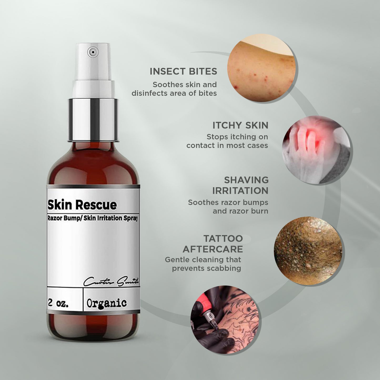 Skin Rescue Spray – Hydrating & Soothing Mist for Skin Repair